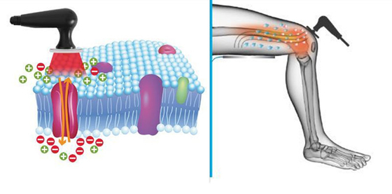 Van het de Therapiemateriaal rf van de lichaamsmassage 300khz Slimme Tecar ROOT CET van de de Hittetherapie